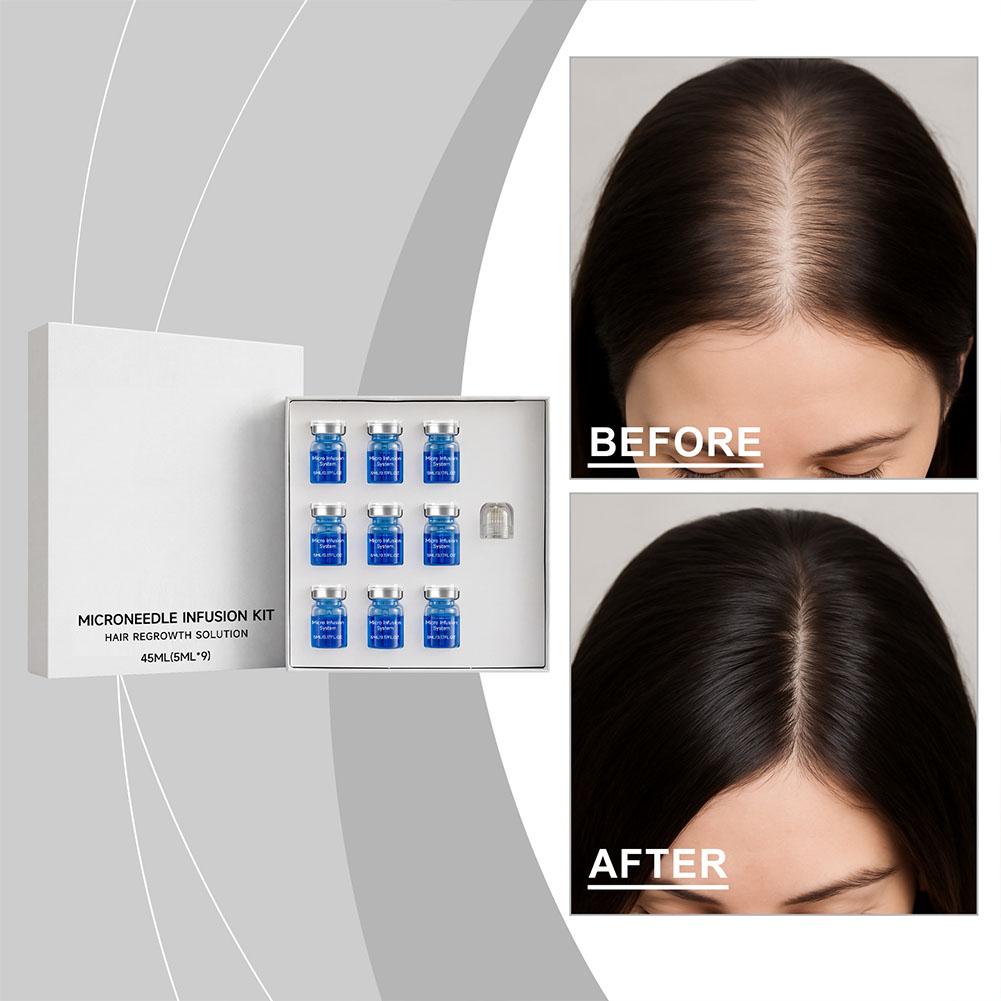 Derma Roller 0.25 - Zestaw do pielęgnacji włosów: serum z
