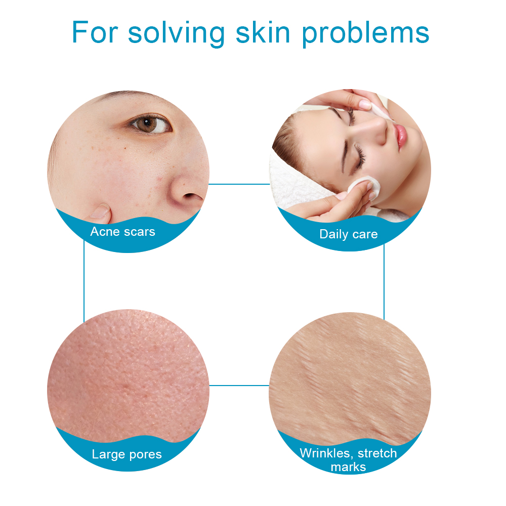 1 szt. Tytanowy Derma Roller 5 – Derma Roller 0.25 recenzja i cena